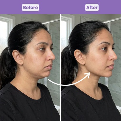 LymphaFlow-Lymphatic Face Brush