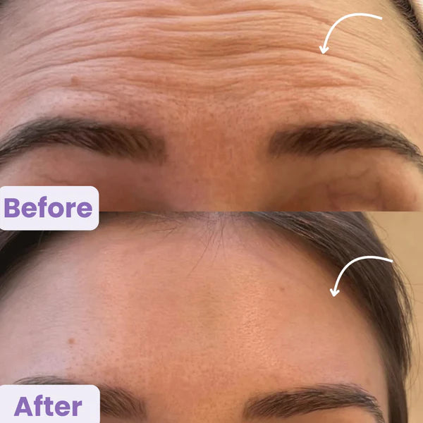 LymphaFlow-Lymphatic Face Brush