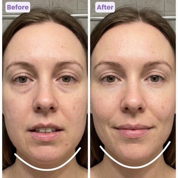 LymphaFlow-Lymphatic Face Brush